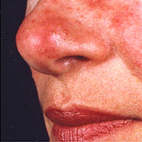 Dermatology Associates Articles In Health and Wellness Magazine