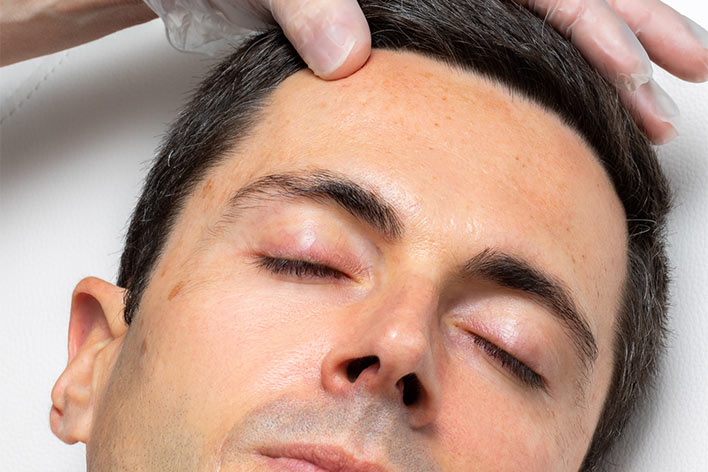 Conditions of the Skin